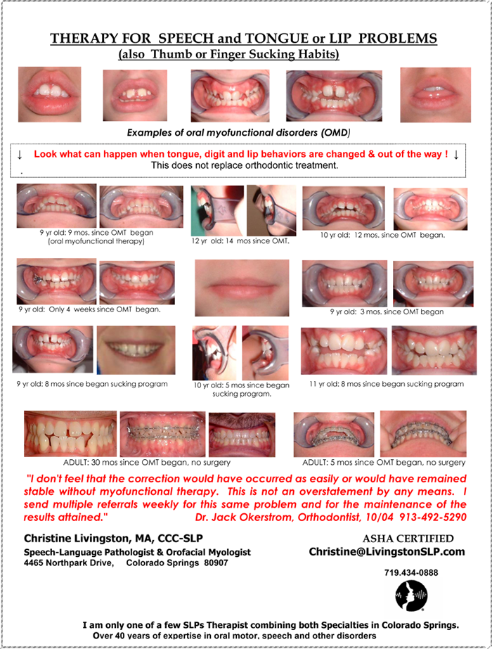 pictures of patient's teeth 